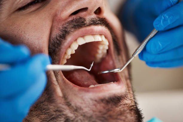 Best Emergency Dental Care for Broken or Chipped Teeth in Mount Cob, PA
